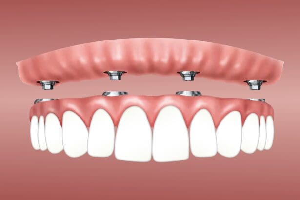 30 Best Dental Implants Near Me