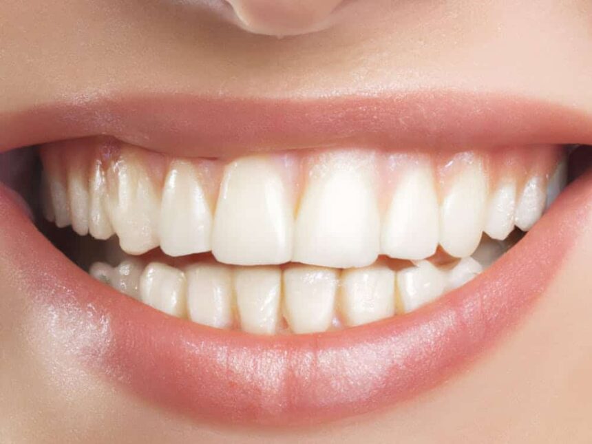 15 Best Teeth Whitening Australia
