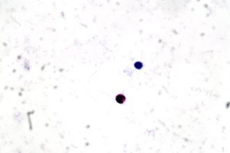 What Is Crypto' Parasite?