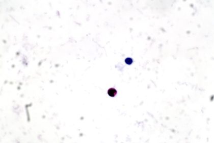 What Is Crypto' Parasite?