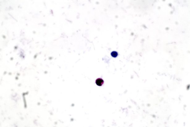 What Is Crypto' Parasite?