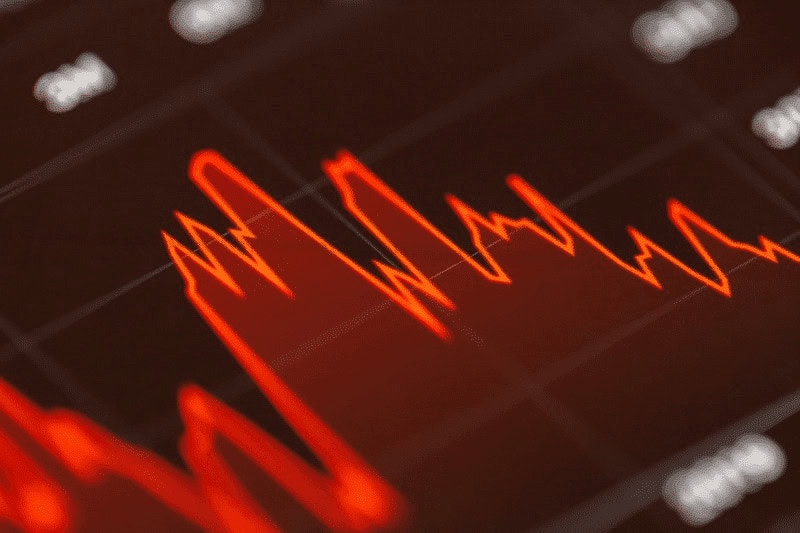 Money Flow Index (MFI) Best Indicator For Forex Trading