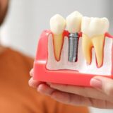 10 Top Dental Implant Practice Tools For Oral Surgeons