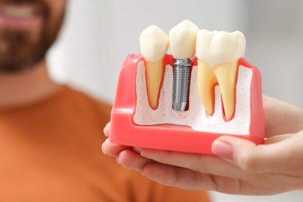 10 Top Dental Implant Practice Tools For Oral Surgeons