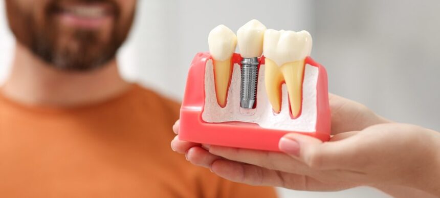 10 Top Dental Implant Practice Tools For Oral Surgeons